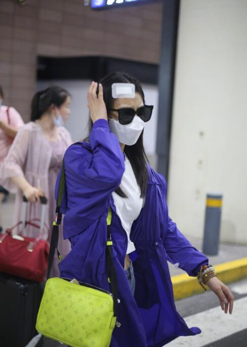 黄圣依拍戏头部受伤后现身，头顶纱布录影超敬
