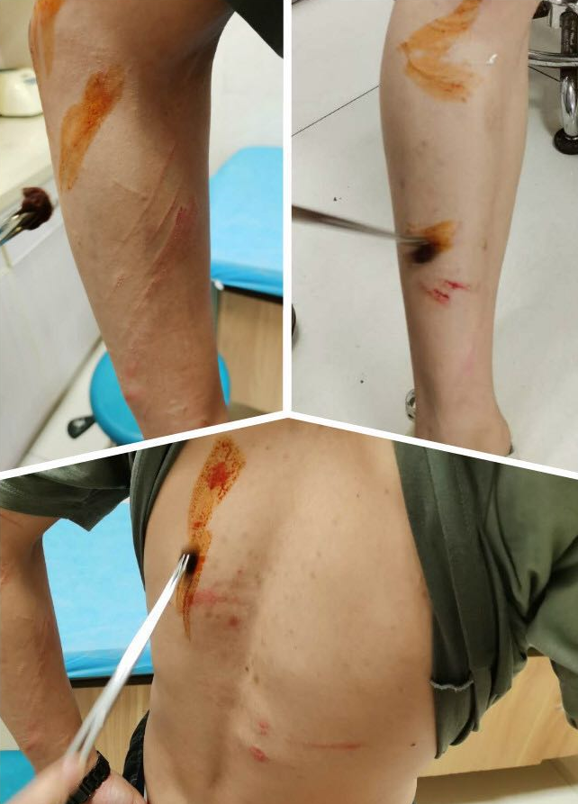 “没力气了，你们太能跑！”面对警察追捕，男