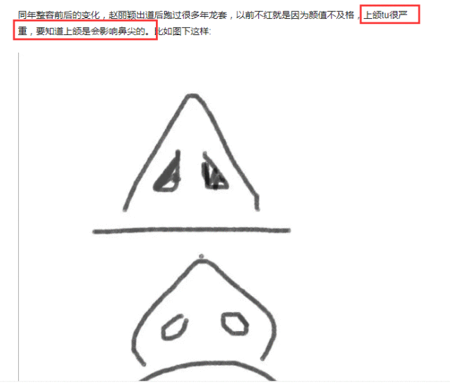 赵丽颖不是纯天然美女？黑粉发文晒图力证做了