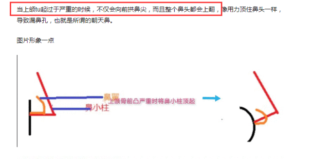 赵丽颖不是纯天然美女？黑粉发文晒图力证做了