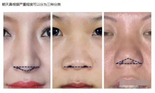 赵丽颖不是纯天然美女？黑粉发文晒图力证做了