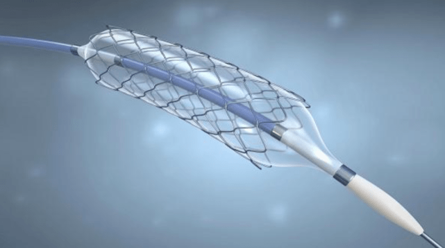 快评丨最低中标价469元，“冠脉支架不如锅贵”