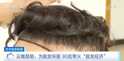 中国平均6人中就有1人脱发,植发群体超半数为