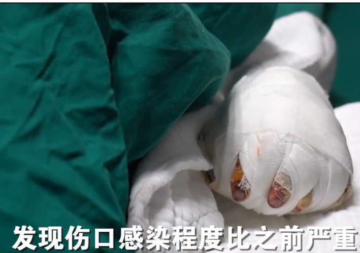 震怒！抚顺亲妈虐童案后，又曝广东男童被父亲