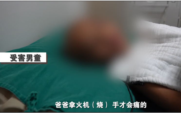 震怒！抚顺亲妈虐童案后，又曝广东男童被父亲