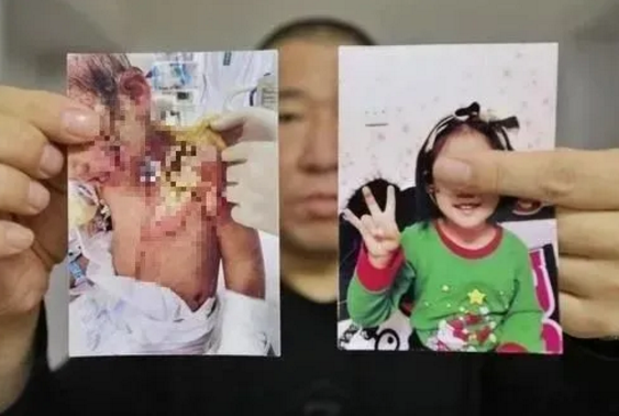 震怒！抚顺亲妈虐童案后，又曝广东男童被父亲