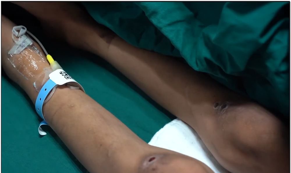 震怒！抚顺亲妈虐童案后，又曝广东男童被父亲