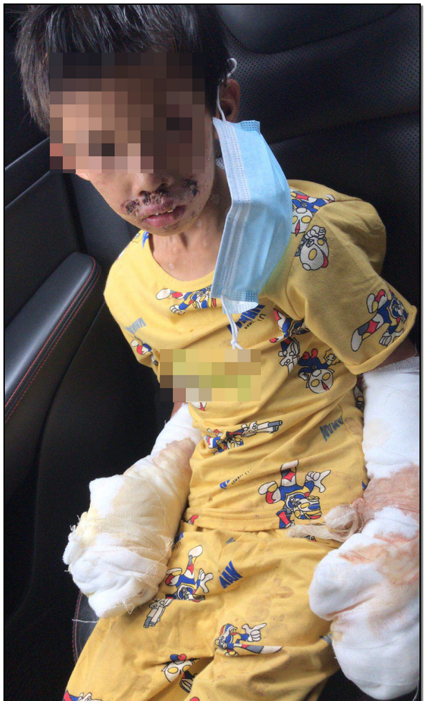 震怒！抚顺亲妈虐童案后，又曝广东男童被父亲