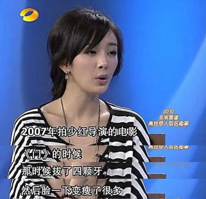 昔日偶像杨幂说拔智齿能瘦脸，郑爽却质疑，评